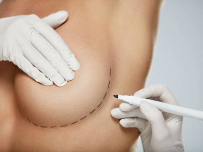 seno chirurgia pennarello coppa