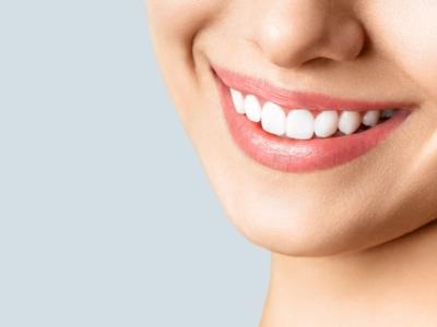 Kit sbiancante denti: l’invenzione USA fa record di vendite