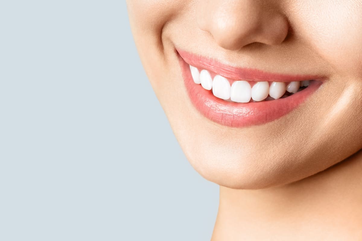 sorriso donna denti bianchi
