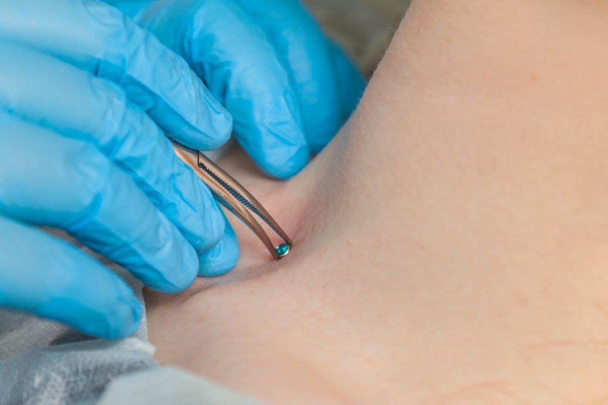 microdermal piercing