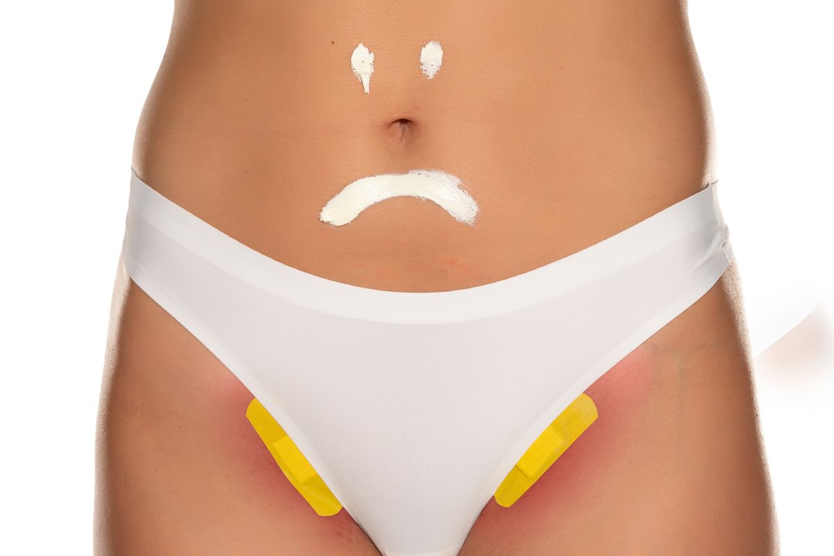 cerotti irritazione inguine donna