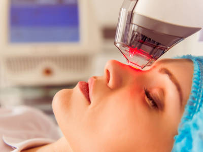 Laserterapia: come funziona il metodo per ridurre gli inestetismi sul viso