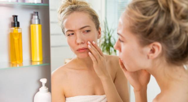 Dieta anti brufoli: tutti i cibi sì e no per sconfiggere l&#8217;acne