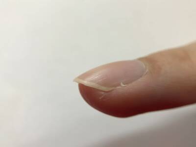 La lunula delle unghie: come controllarla per monitorare la nostra salute