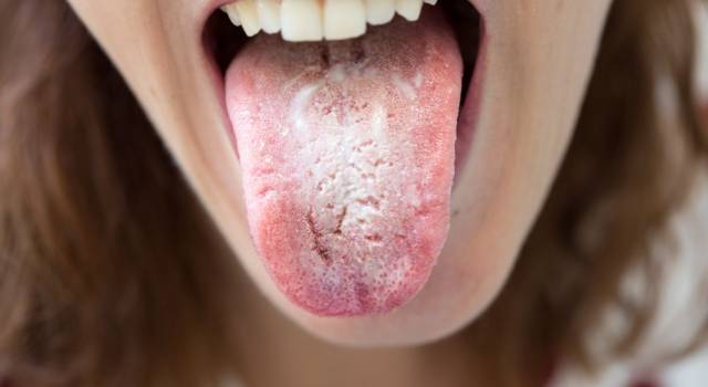 Come pulire la lingua
