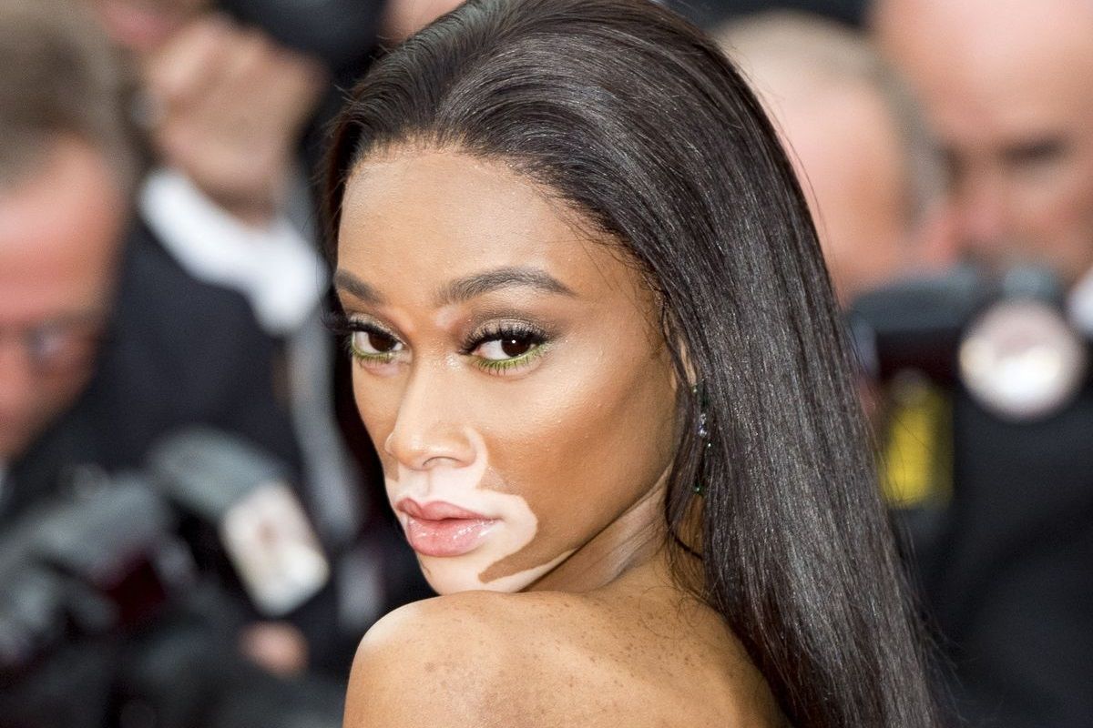 Winnie Harlow