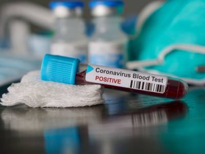 Coronavirus: le mappe del contagio in tempo reale
