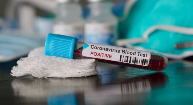 Coronavirus: test rapido in arrivo, risultato in 15 minuti