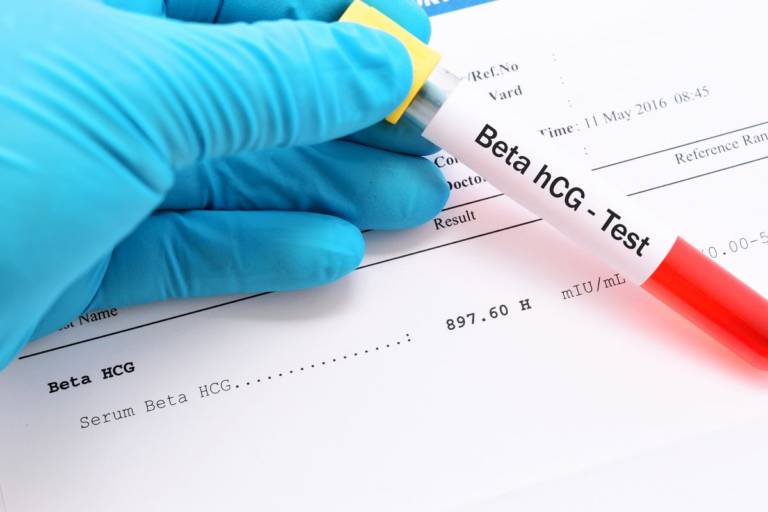 Come Fare Per Aumentare Le Beta Hcg