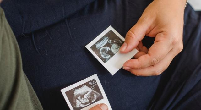 Quali sono le caratteristiche della gravidanza gemellare?