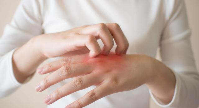 Cause e sintomi tipici della dermatite atopica