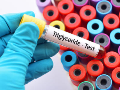 Trigliceridi: cosa sono e come tenerli sotto controllo