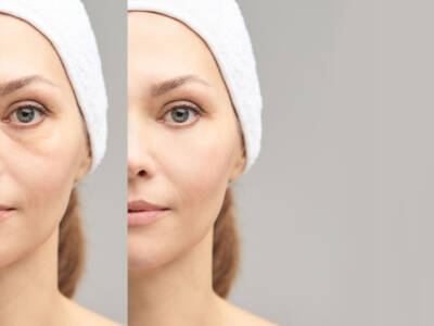 truccarsi per coprire le occhiaie