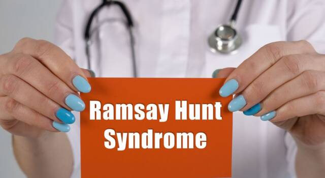 Sindrome Ramsay Hunt: cause e sintomi della malattia che ha colpito Justin Bieber