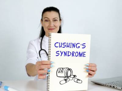 sindrome di cushing