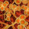 Allarme Candida auris in Italia: il “fungo killer” torna a fare paura