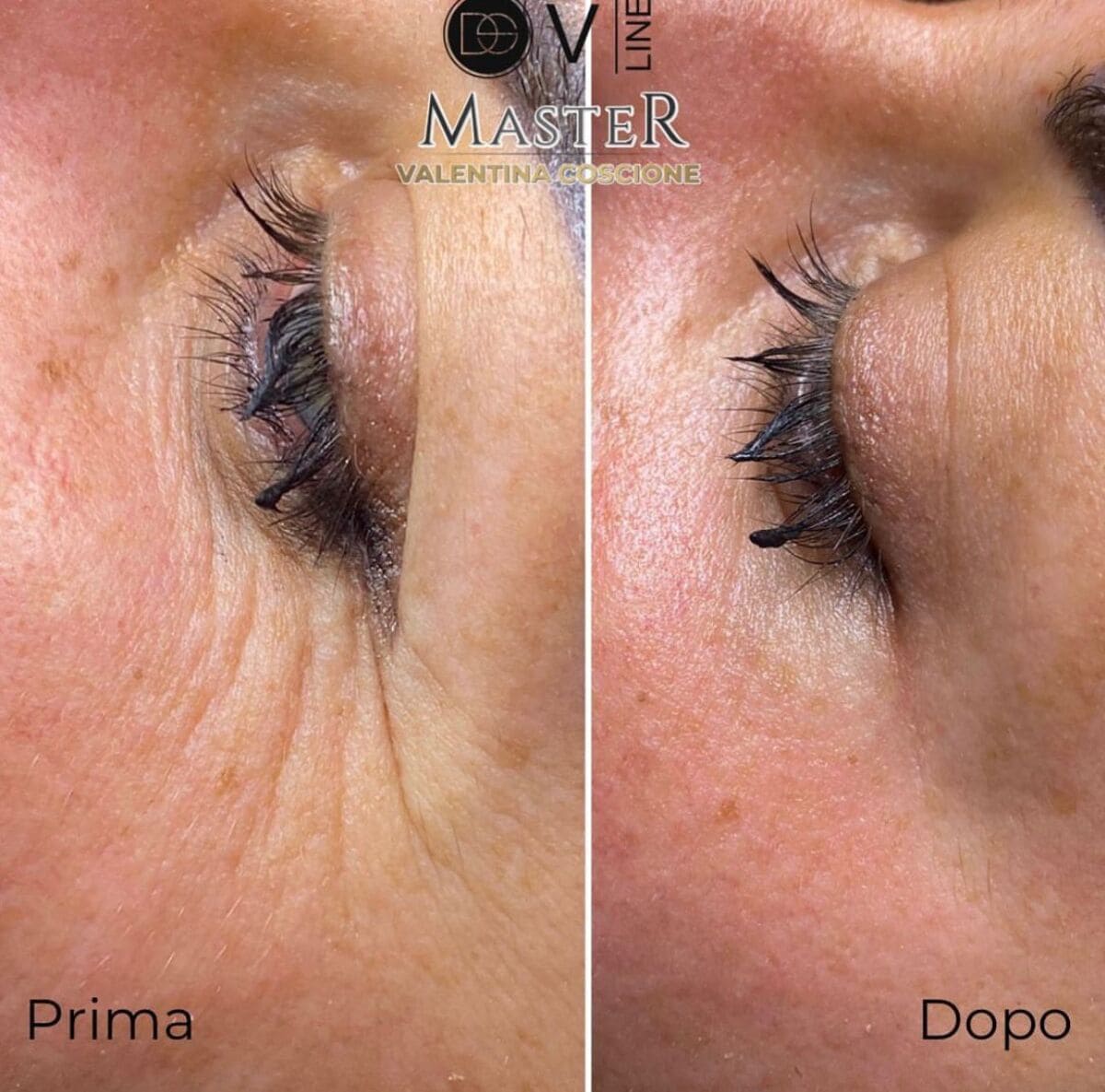 prima dopo valentina coscione