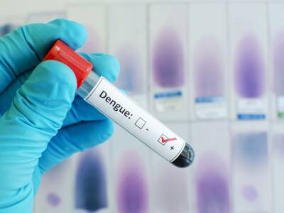 test sangue virus dengue