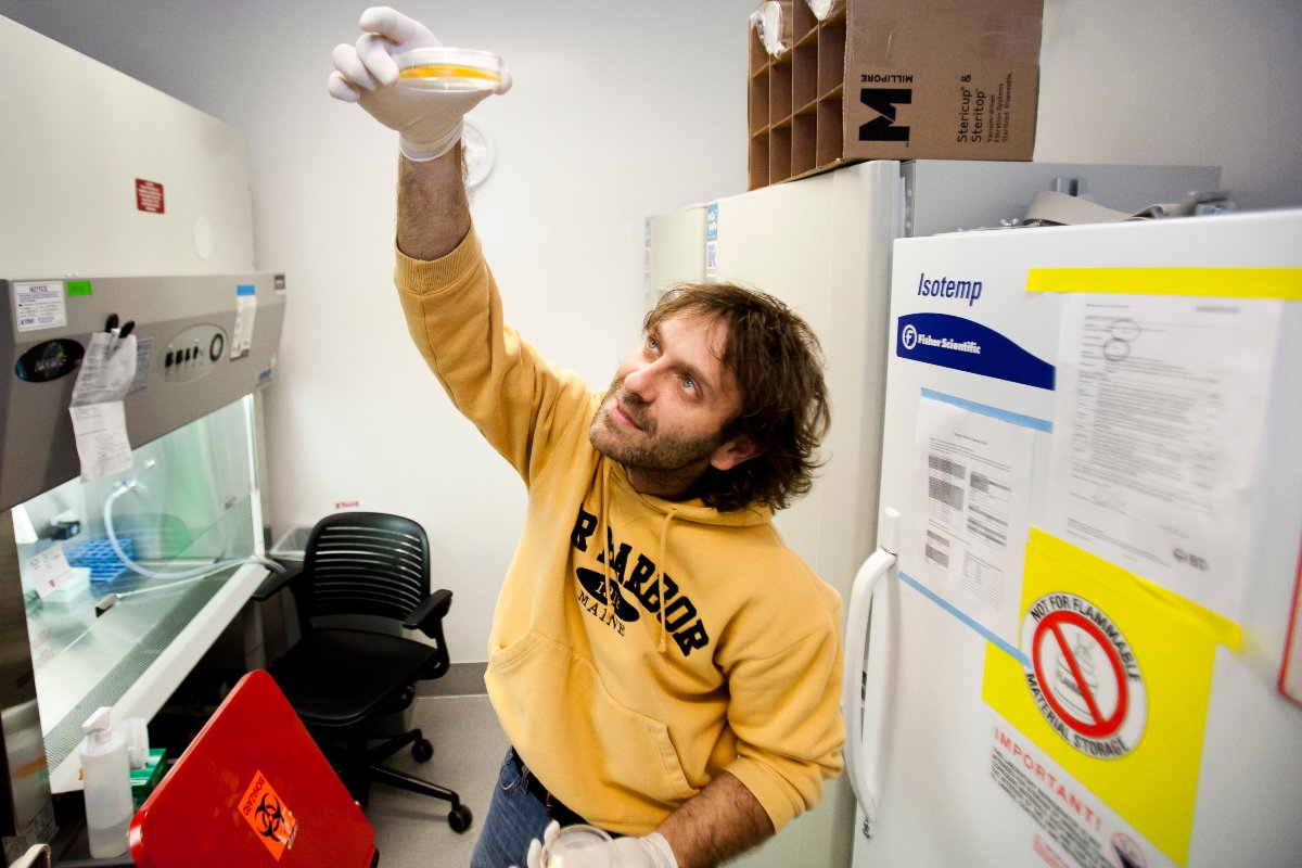 Vittorio Sebastiano, l'esperto di biologia cellulare e dello sviluppo mostra al Mercury News una piastra piena di cellule staminali in crescita. (Dai Sugano/Mercury News) (Foto di MediaNews Group/Bay Area News via Getty Images)